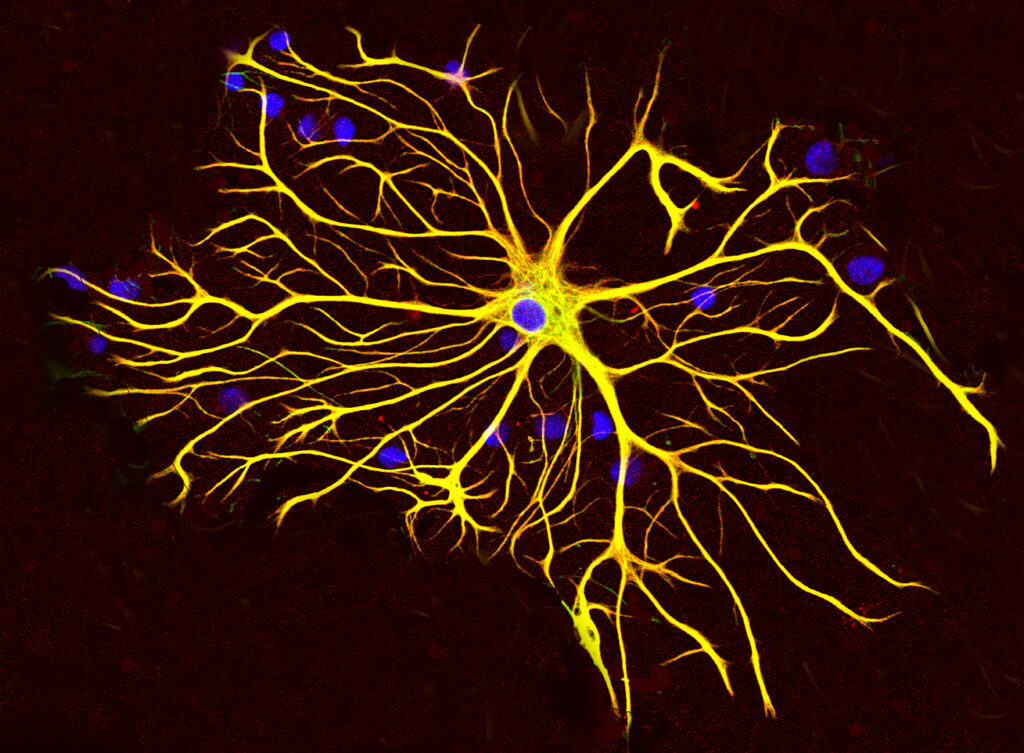 Astrocyte cells in the brain, involved in Alzheimer's disease progression and potential treatment targets.